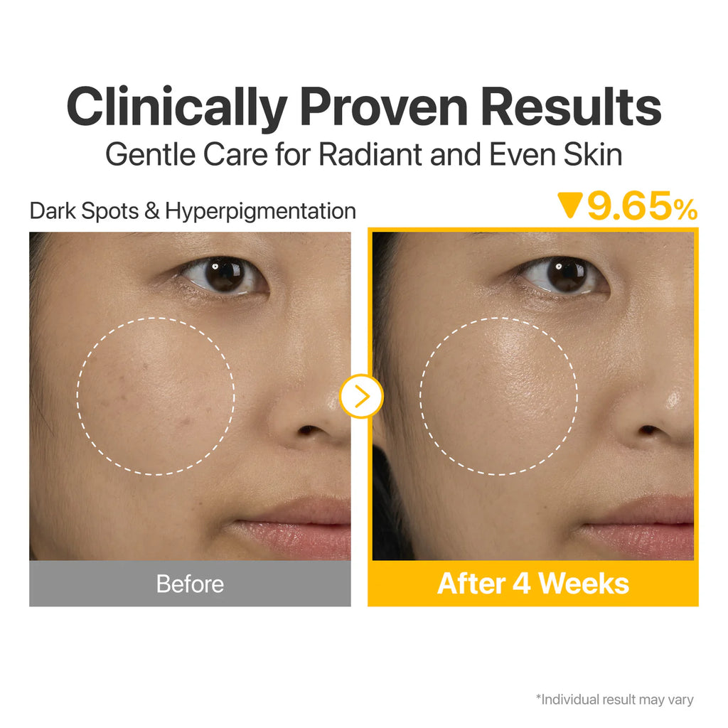numbuzin - No.5 Vitamin Concentrated Serum