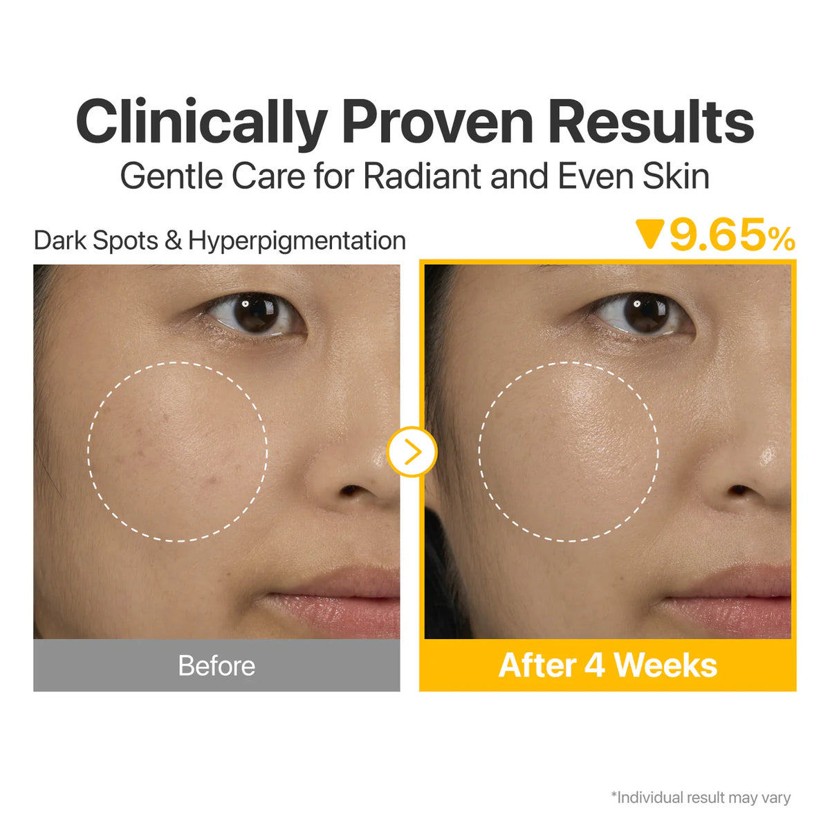 numbuzin - No.5 Vitamin Concentrated Serum