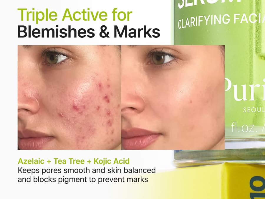 PURITO SEOUL - Azelaic Acid 10 Kojic Tea Tree Serum