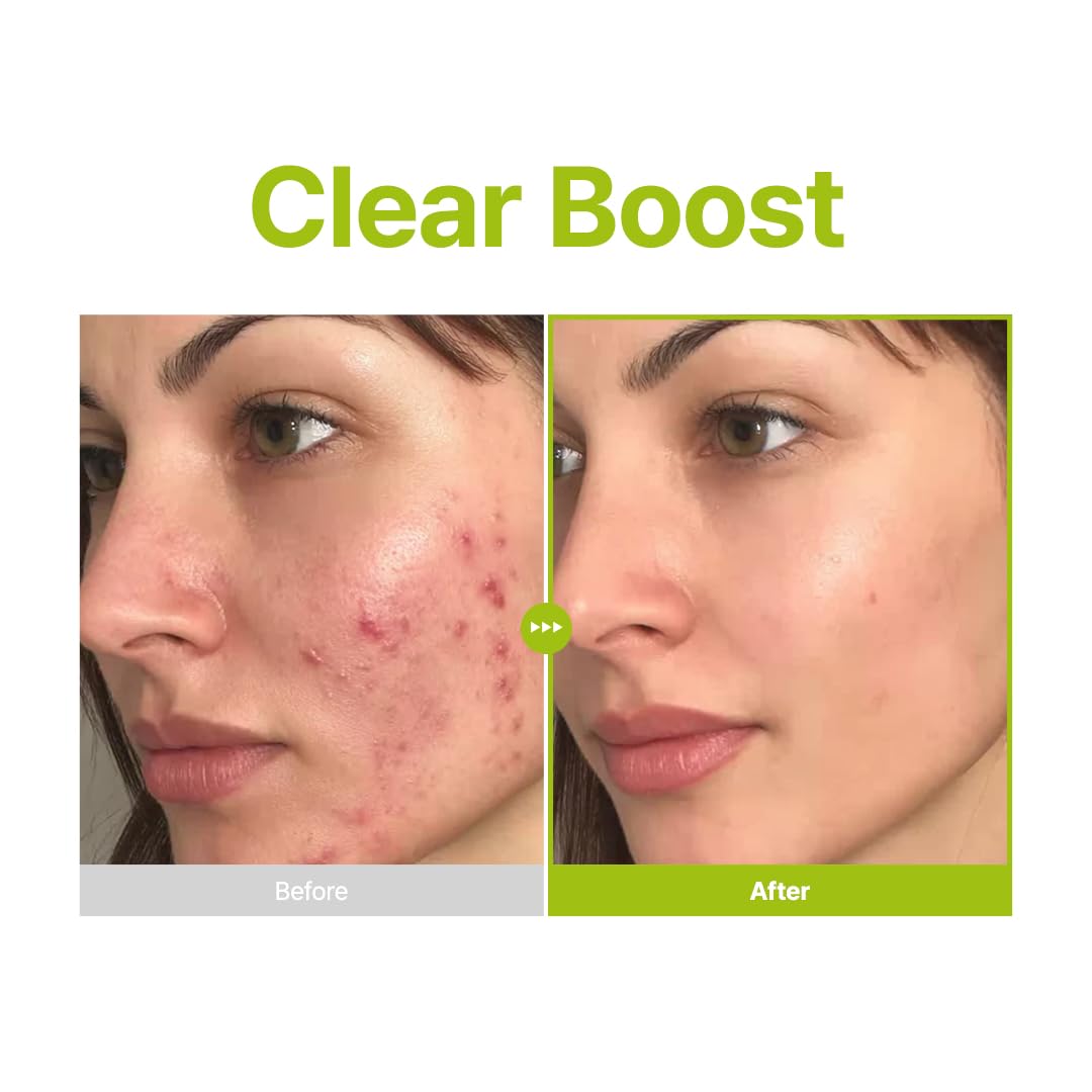 PURITO SEOUL - Azelaic Acid 10 Kojic Tea Tree Serum