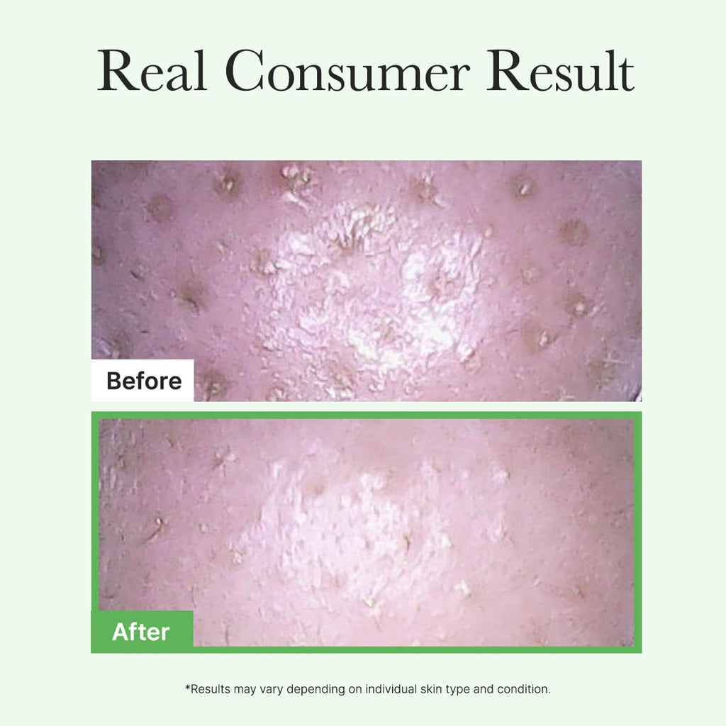 Arencia - Pore Melt Mochi Cleansing Oil