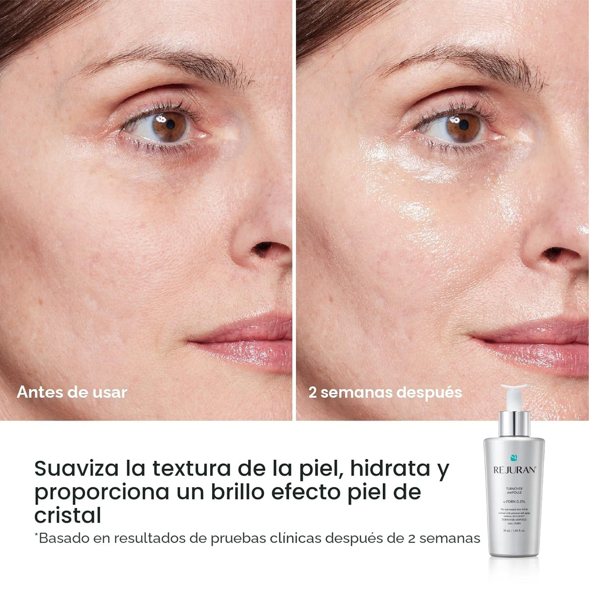 REJURAN - Turnover Ampoule
