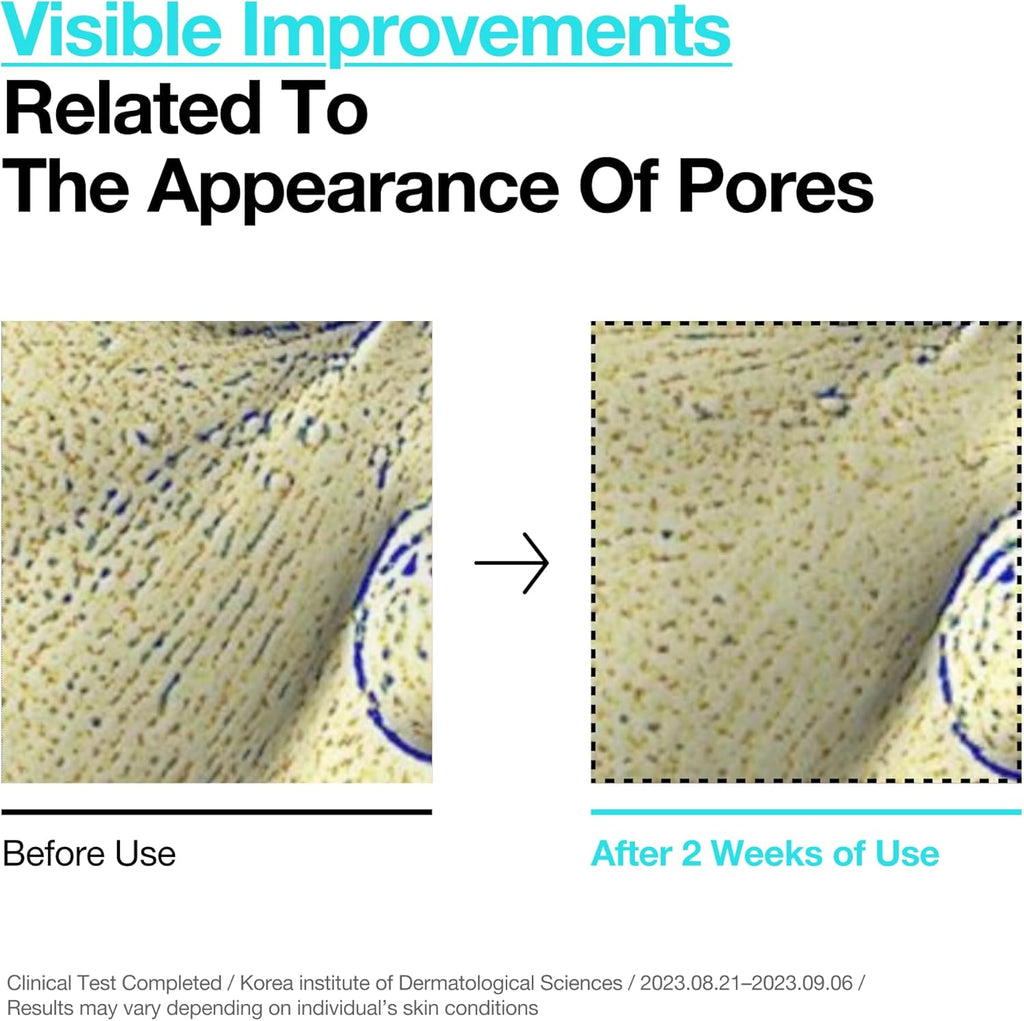 Anua - BHA 2% Gentle Exfoliating Toner