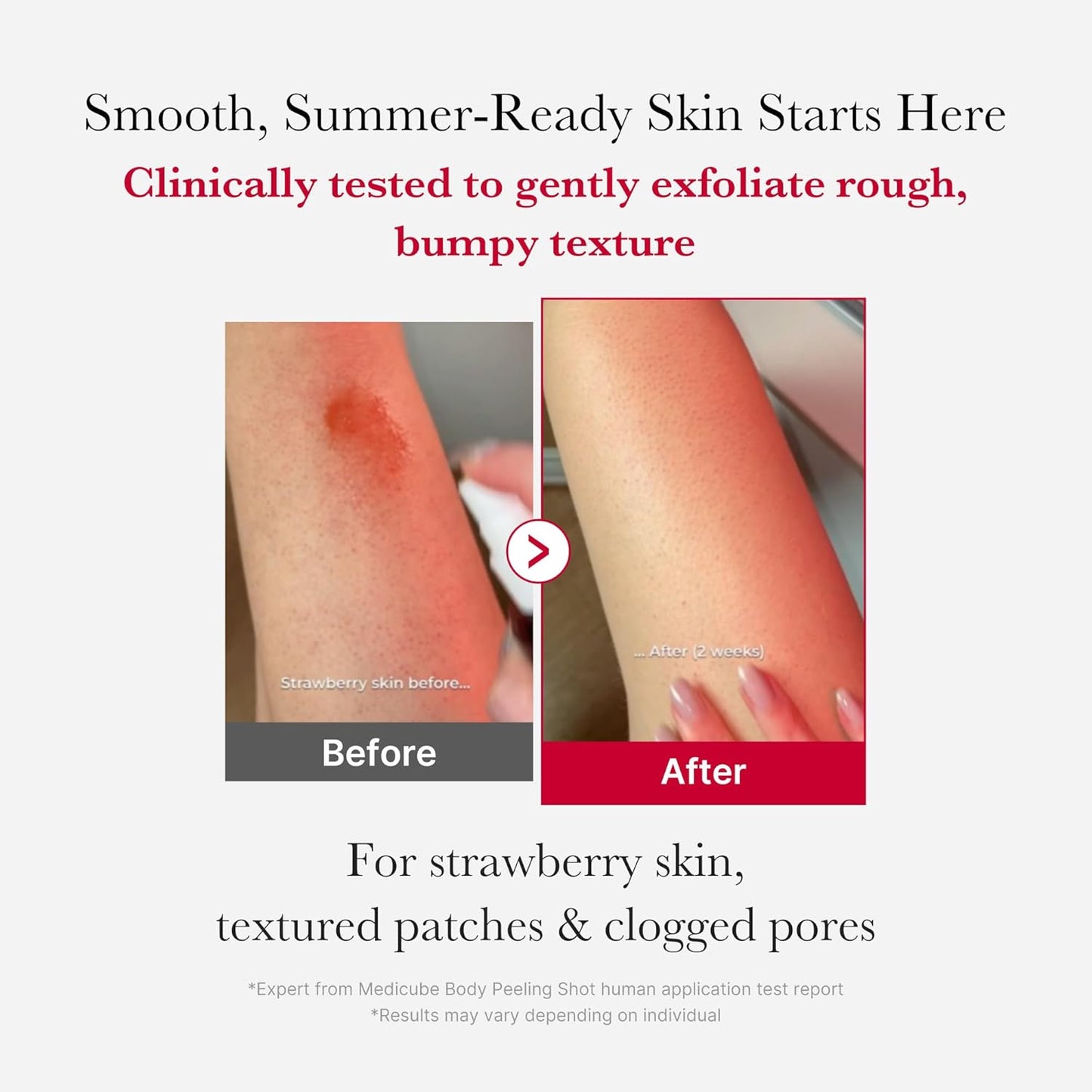 medicube - Red Acne Body Peeling Shot