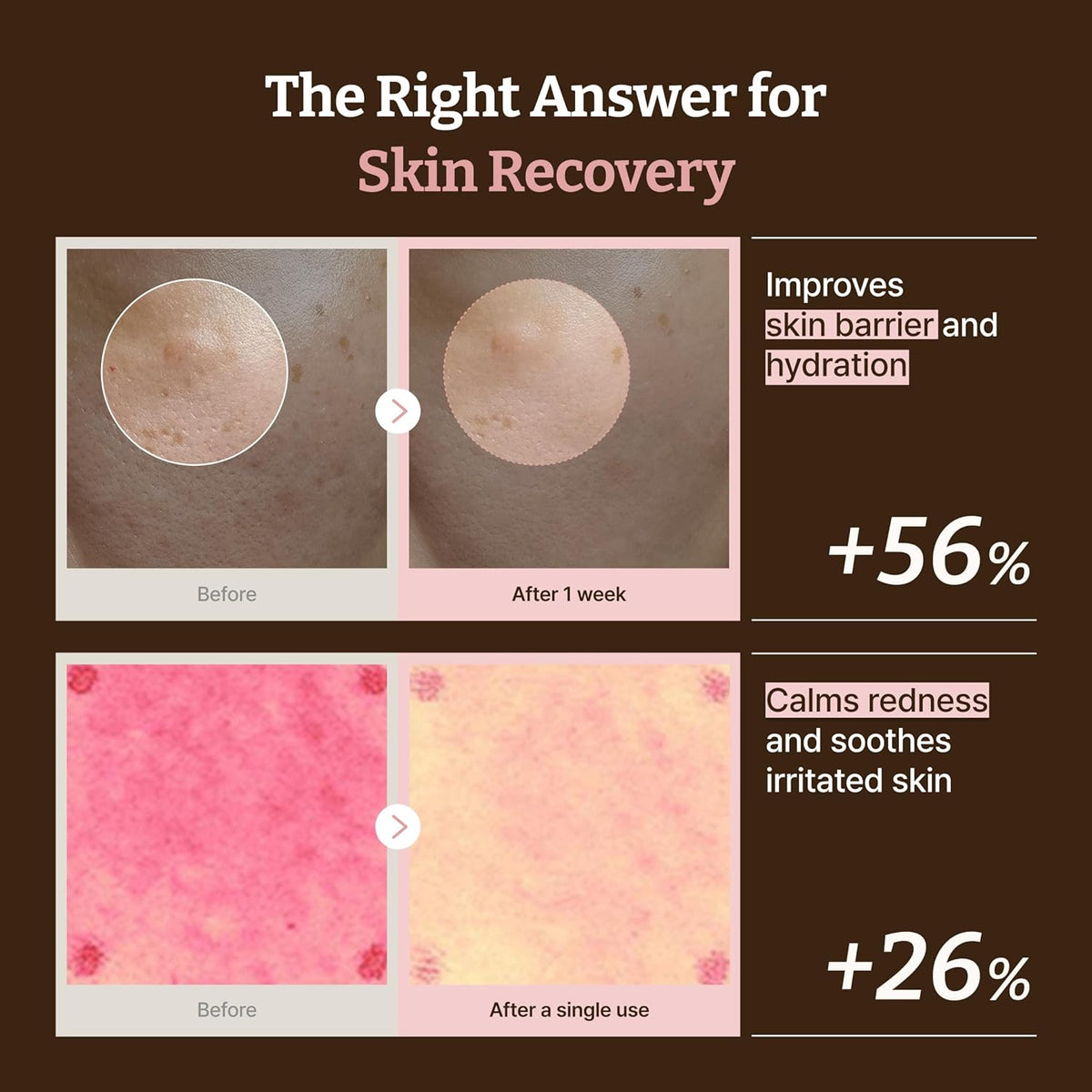 Dr. Reju-All - Advanced PDRN  Rejenating Cream