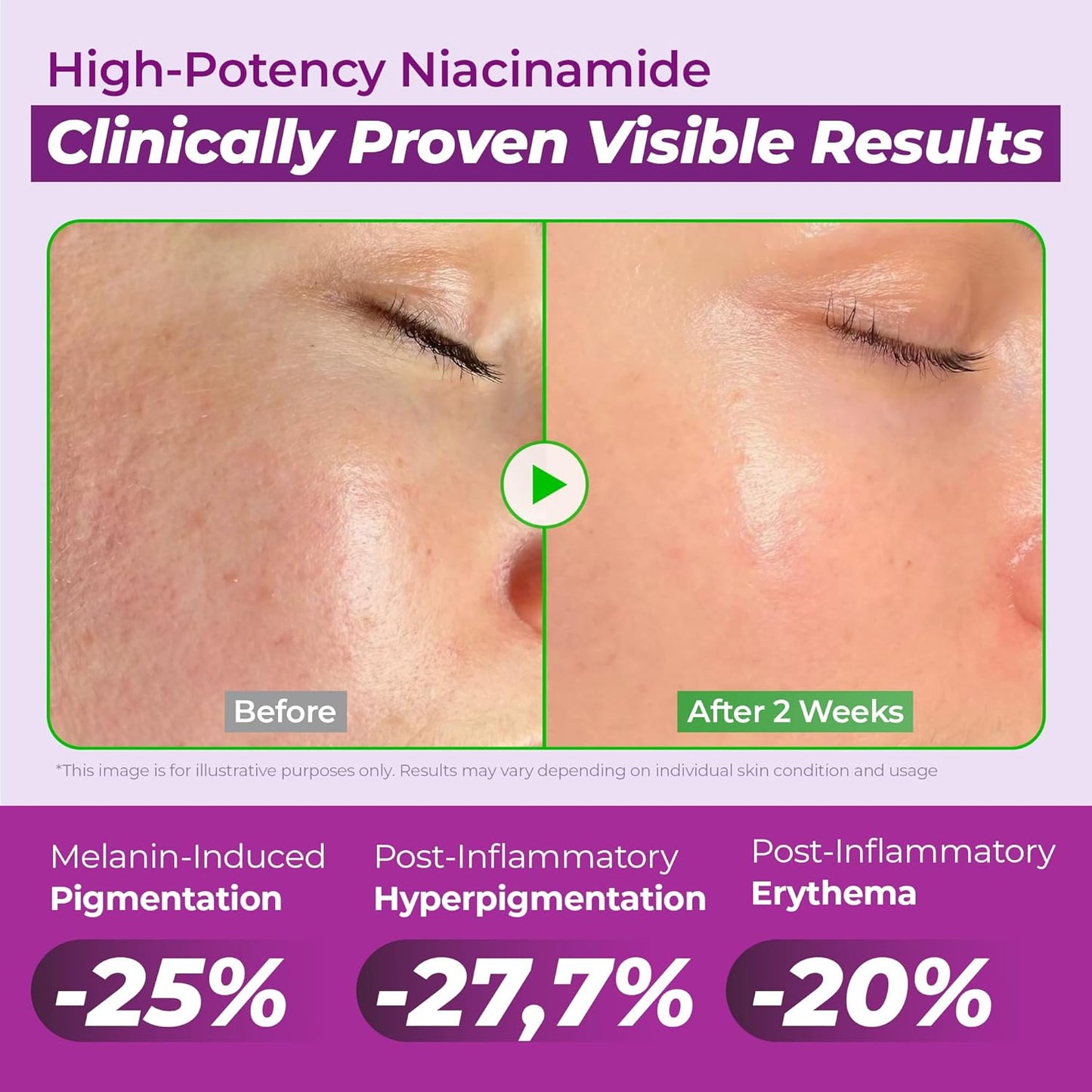 JUMISO - Niacinamide 20 Serum