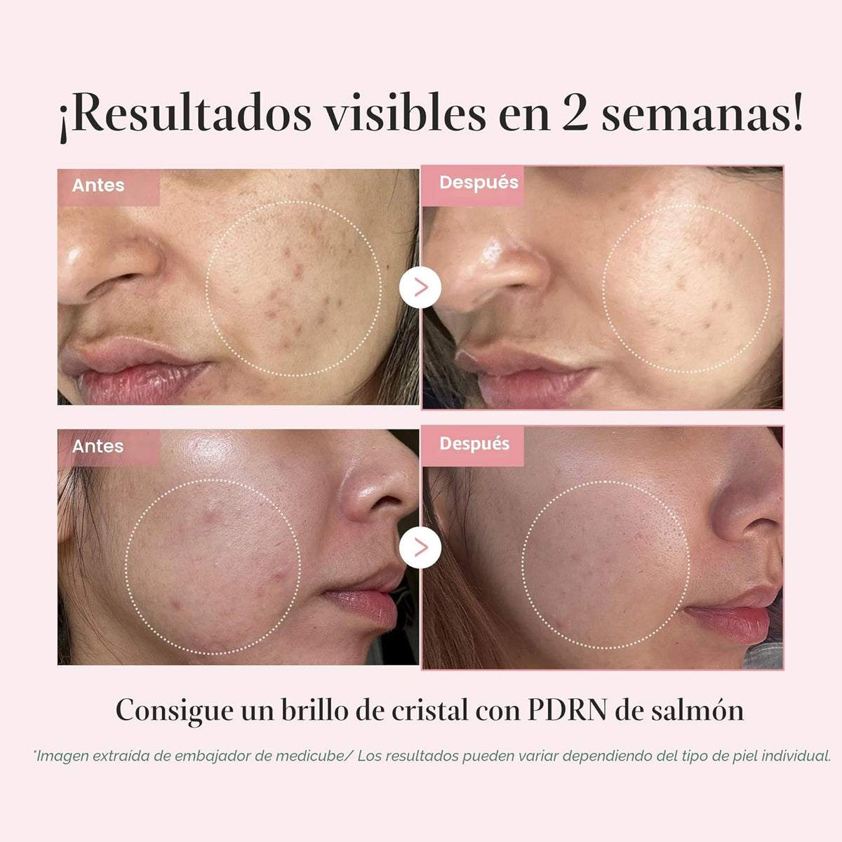 medicube - PDRN Glow Kit