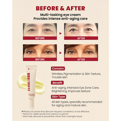 K-SECRET - SEOUL 1988 Eye Cream : Retinal Liposome 4% + Fermented Bean