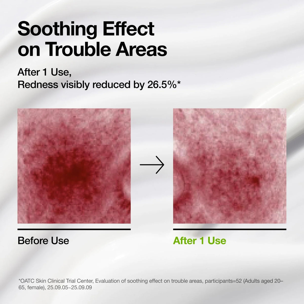 Anua - Azelaic Acid Cica Skin Soothing Moisturizer